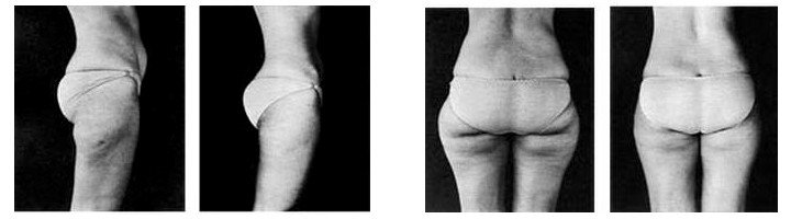 before and after photos